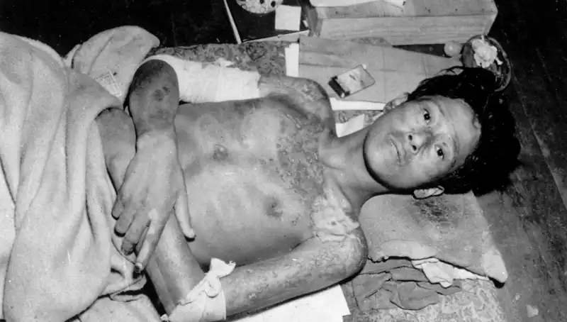 80 Yıl Sonra Nagasaki’den Gelen Acil Uyarı: Nükleer Felaket Kapıda mı?