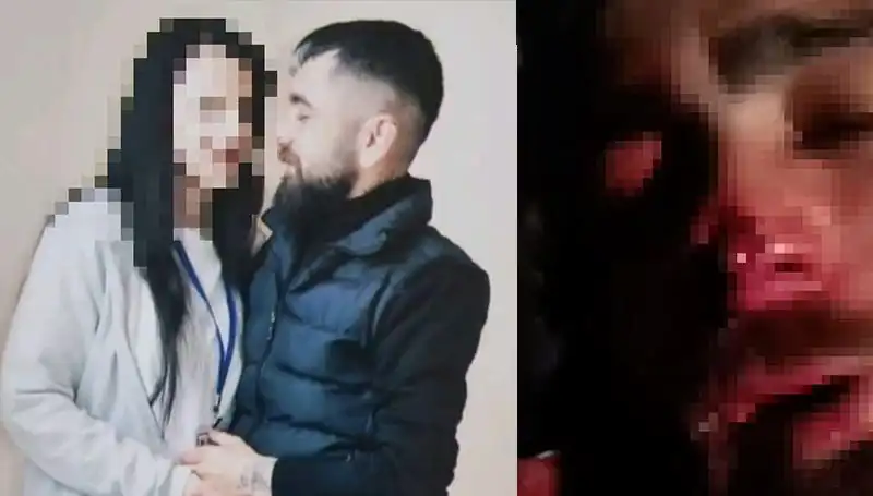 Eski Sevgiliye Dehşet: Abisi Tarafından Kulağı ve Burnu Koparıldı!