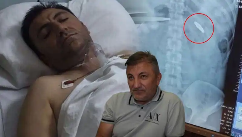 15 Temmuz’un Gölgesinde: Kurşunla Yaralananlar, Hayatta Kalanların Hikayeleri