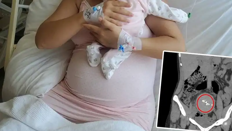 Doğumda Üzerine Gazlı Bez Bırakılan Bebek İki Yıl Sonra Ortaya Çıktı